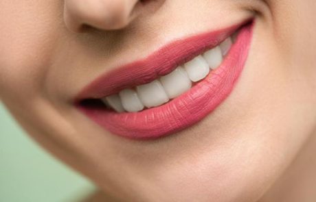 5 טיפים למה כדאי לעשות ציפוי שיניים